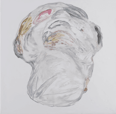 Head with tender ulcers